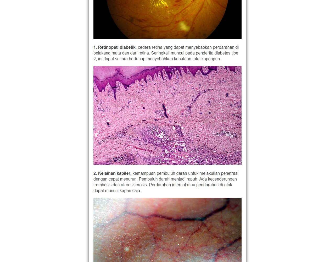 Glucoactive 5